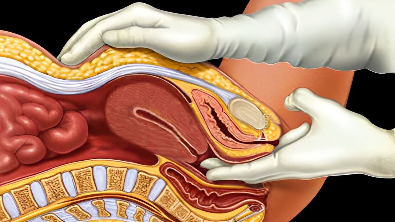 how to correctly stimulate the G-spot in women